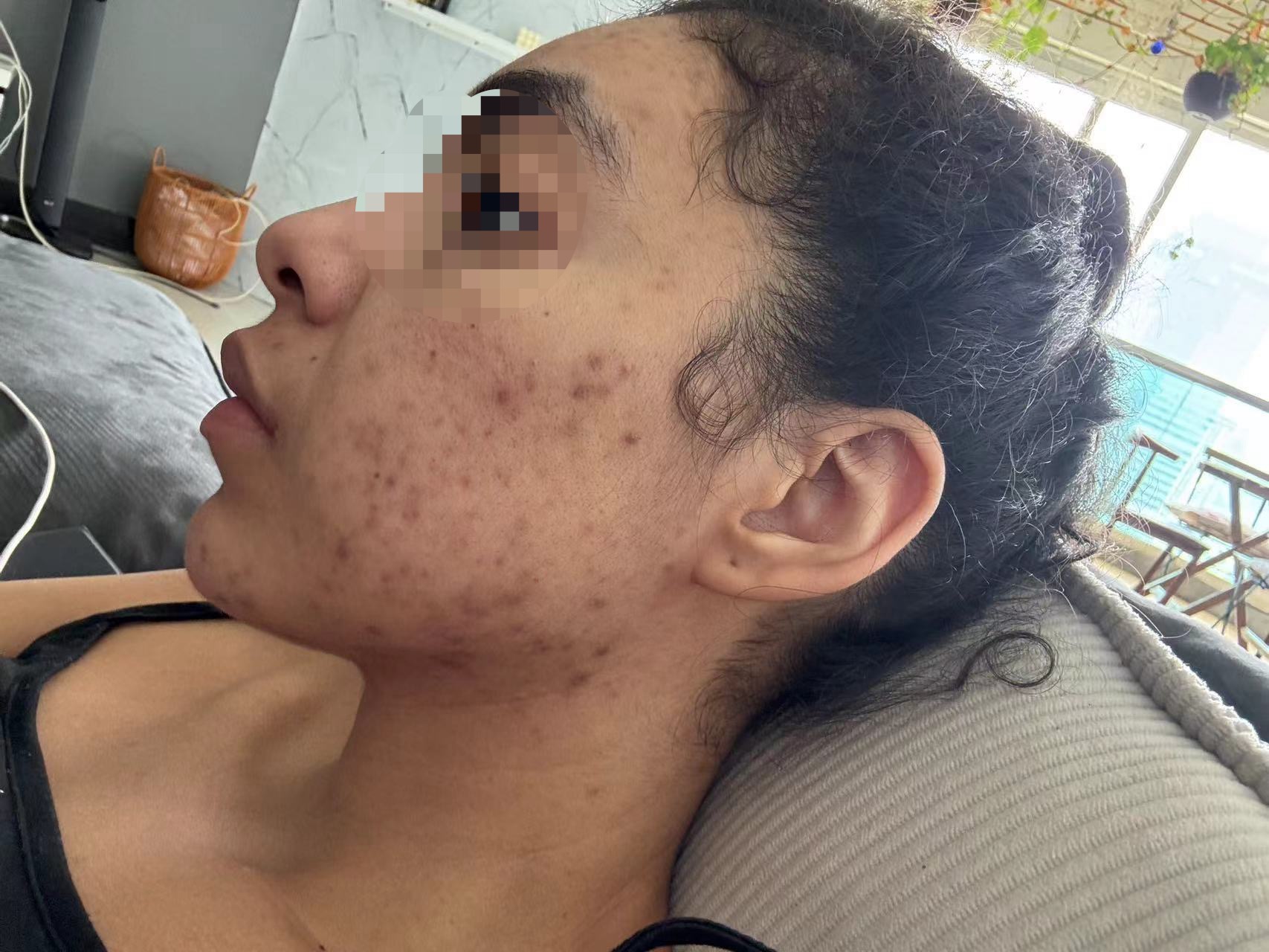 Customer skin progress photo