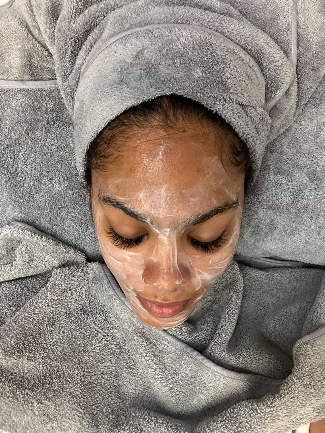 Customer with a treatment applied, lying on a towel