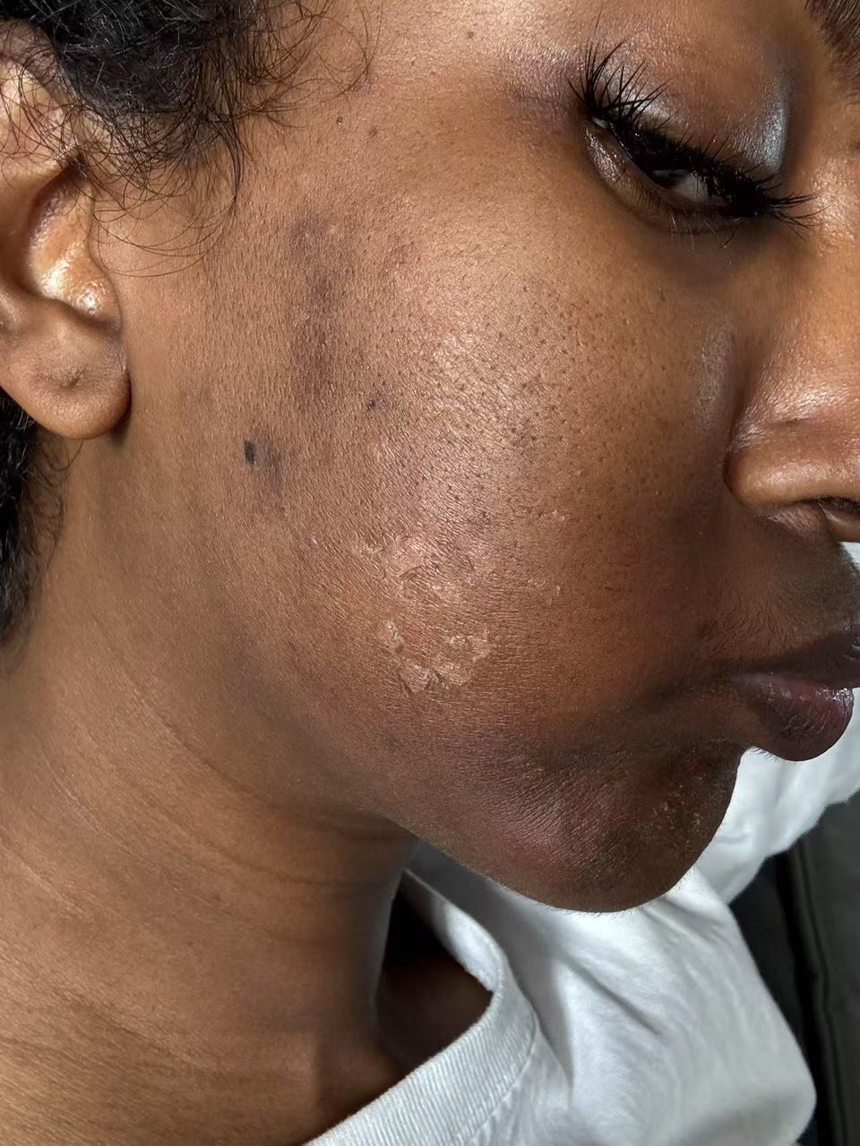 Customer photo after treatment