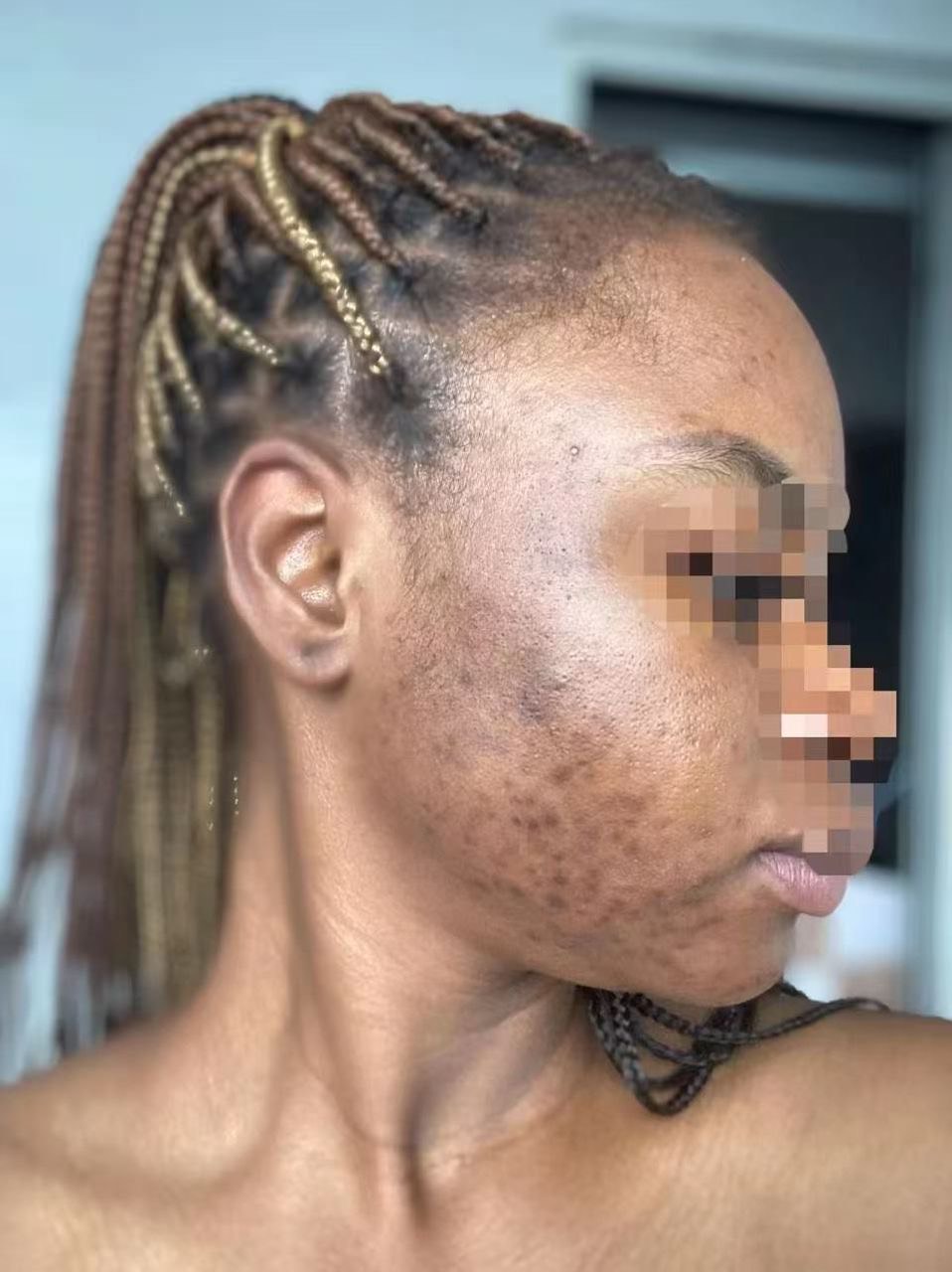Customer photo before treatment, second angle
